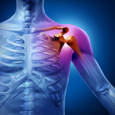 Shoulder Dislocation